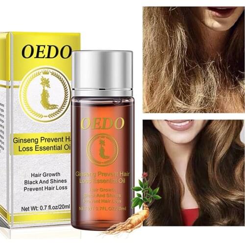 20ml Preventing Hair Loss Essential Oil Ginseng Hair Growth Essence Repair Damage Hair Nourish Hair Roots Accelerate Hair Growth