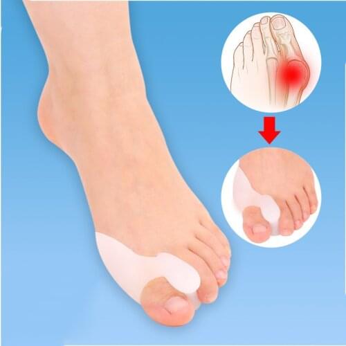 New Hotsale Beetle-crusher Big Bone Ectropion Toe Separator outer Appliance Professional Technology Feet Care Products