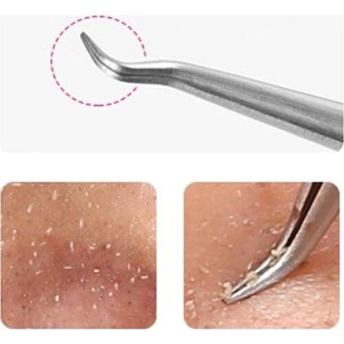 Stainless Steel Straight Bend Curved Blackhead Acne Clip Tweezer Pimple Comedone Remover Kit Face Cleaner