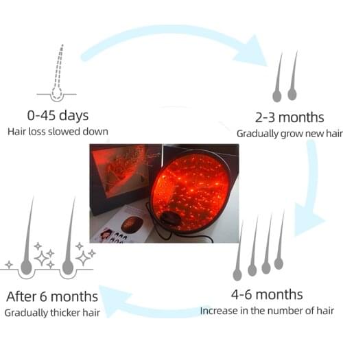 Best Selling Hair Growth Products For Sale Not LED Real Laser