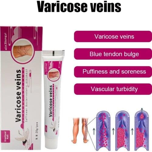 20g Varicose Vein Cream Effective Treatment Vasculitis Blood Vessel Swelling Spider Leg Massage Varicose ​Ointment