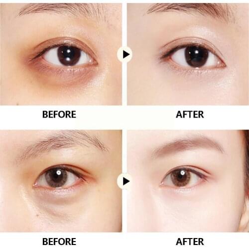 Panda Starry Eye Mask Hydrating Moisturizing And Improving Dark Lines Eye Circles Fine Mask Starry L4U7