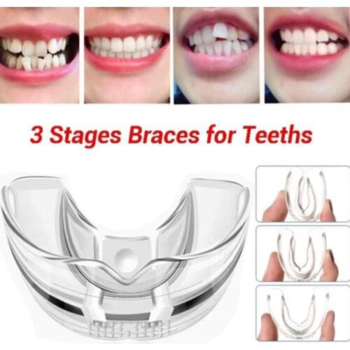 Denture corrector adult denture retainer buck-toothed artifact overnight anti-molars fixed silicone braces