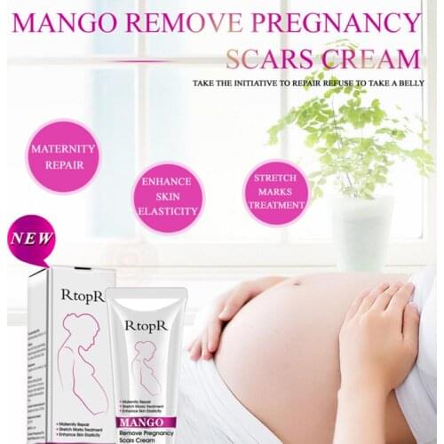 Anti Stretch Marks Cream Mango Remove Pregnancy Skin Treatment Maternal Anti-Aging Repair Anti-Wrinkle Firming Body Creams TSLM1