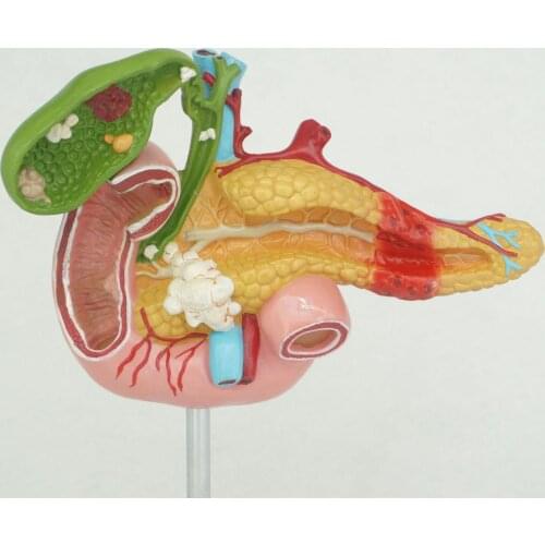 Human Anatomical Duodenum Gall Bladder Disease Anatomy Medical Model Learning Resources