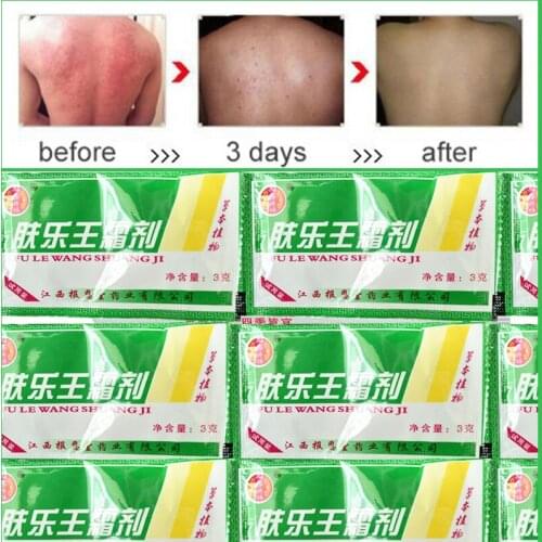 6PCS Psoriasis Cream Psoriasis Dermatitis And Eczema Pruritus Psoriasis Ointment Skin Problems Treatment Body Cream