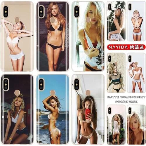 Soft Case For Xiaomi Redmi 9a 7a 8a Note 10 9 8 7 Pro Max 10s 9s 8T Prime 9at 5G Cover Alexis Ren modelo bikini Gir Fundas
