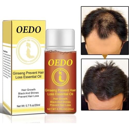 OEDO 20ML Ginseng Hair Growth Preventing Hair Loss Liquid Damage Hair Repair Treatment Dense Fast Restoration TSLM1