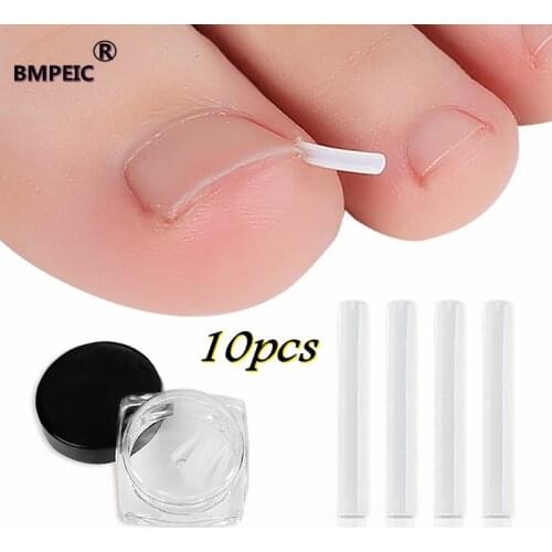 10pcs Ingrown Toenail Correction Tool Ingrown Toe Nail Treatment Elastic Patch Sticker Straightening Clip Brace Pedicure Tool