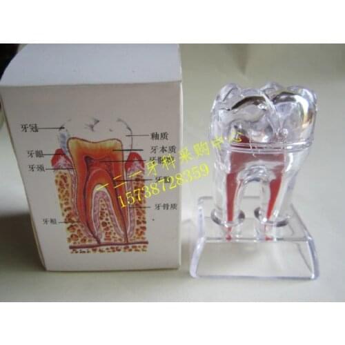 Dental Materials Removable Dental trinkets free shipping
