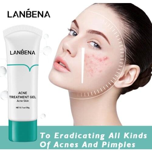 LANBENA Effective Acne Removal Serum Pimple Acne Treatment Essence Herbal Anti-acne Repair Fade Acne Spots Gel Skin Care 20g