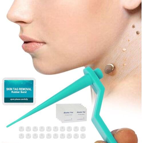 20/10PCS Face Care Mole Wart Tool Mole Wart Remover Micro Skin Tag Removal Kit With Cleansing Swabs Adult Mole Wart Face Care