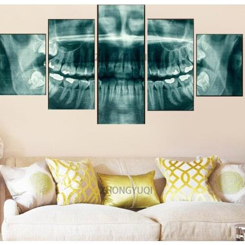 Wall Art Pictures Home Decor Modern HD Prints Canvas 5 Panel Dental Teeth X-Ray Dentist Painting Health Medicine Poster