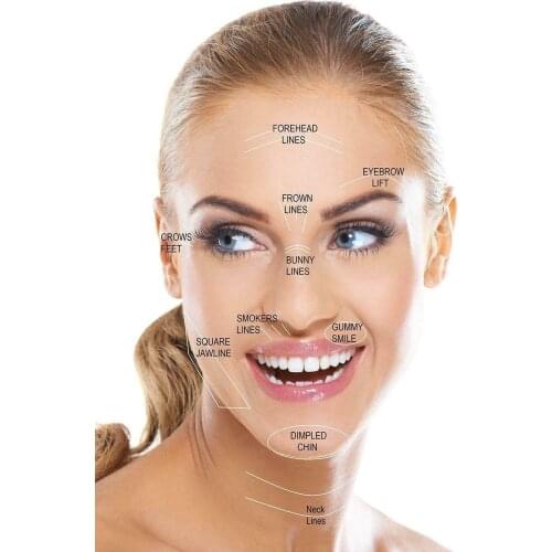 Aesthetics Botox Treatment Areas Advertising picture Art Film Print Silk Poster Home Wall Decor 24x36inch