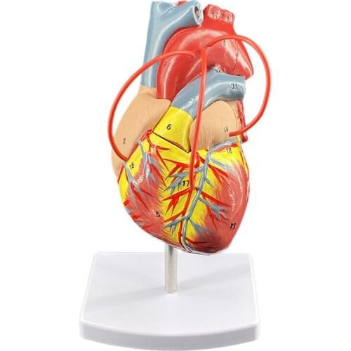 Heart Bypass Human Organ Structure Hierarchical Anatomical Model Internal Organs Hospital Teaching Model