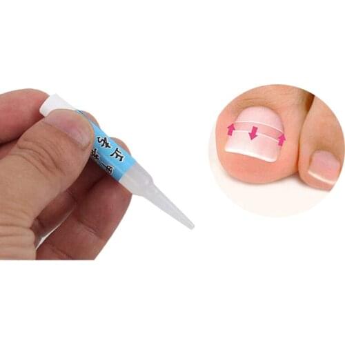 NEW-Nail Glue Ingrown Toenail Correction Pedicure Toe Patch Adhesive Foot Care Tool #8
