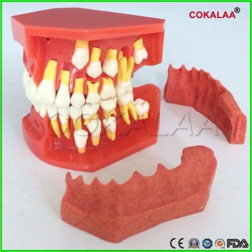 Dental Tooth Teaching Model Children Permanent Tooth Alternative Model Deciduous Teeth Removable Demonstration For Kids Studying