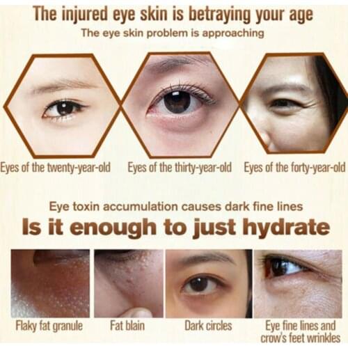 Fatty eye cream Effective Anti-Wrinkle Whitening Skin eye Care cream Dark Remove Moisturizer Anti-Puffiness Granule Circles V4O0