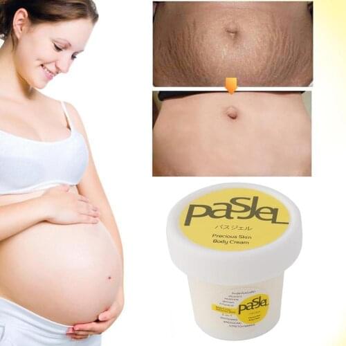 Stretch Mark Repair Cream Powerful Postpartum Obesity Removal Scar Suitable Abdomen Thigh Hip Waist Body Repair Care 50ml