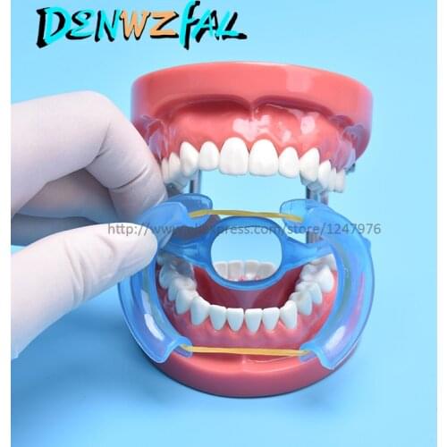 New M Type Mouth Opener New Dental Orthodontic Plastic Cheek Lip Retractor Clear Color Medical or Home Safe Use