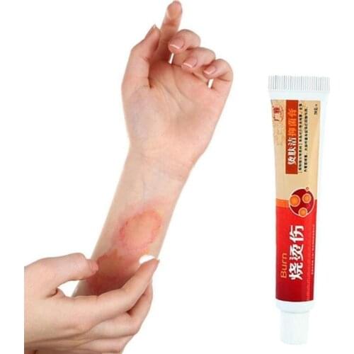 20g Scald Cream Ointment Treatment For Pain Itch Relief Skin Tissue Damage Scar Elimination Blister Bubble Sterilize Antipruriti