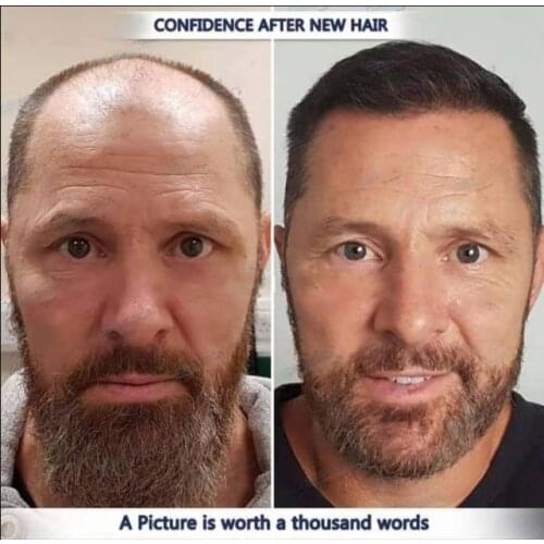 Ancient Secret Recipe for Hair Growth Treatment Shampoo Wild Grow Hair Anti Hair Loss Can Be Used for Baldness