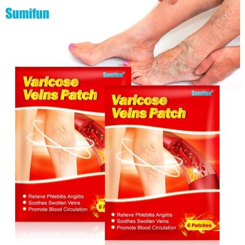 12Pcs Varicose Veins Treatment Patch Varicosity Angiitis Remedy Relief Veins Pain Phlebitis Legs Varicose Veins Plaster
