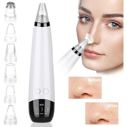 Electric Blackhead Remover Facial Nose Cleansing Pore Acne Cleanser Pore Cleansing Blackhead Instrument