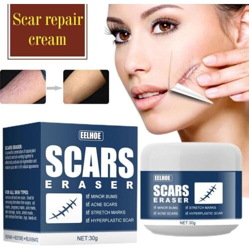 30g Scar cold compress gel Scar Removal Cream Acne Stretch A Corrector Marks Scars Gel Scar Surgical Pigmentation For Body C5B5