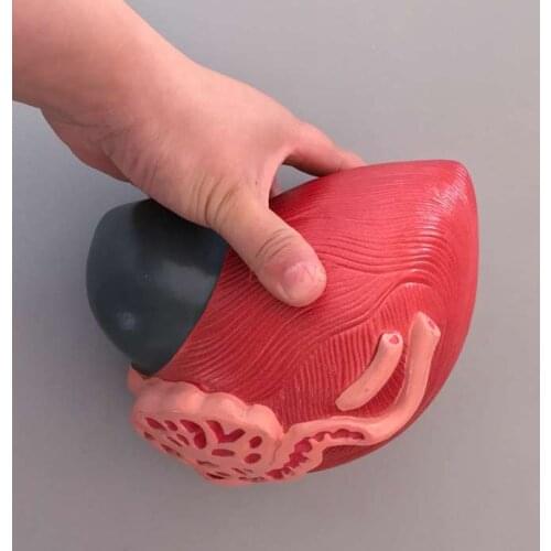 Bladder model male bladder prostate enlargement model urogenital system structure teaching medical teaching aids