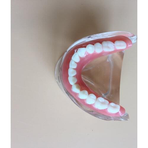 6pcs /pack Dental Teeth Model Removable Interior Mandibular with 2 Implant for Tooth Teaching Study overdenture