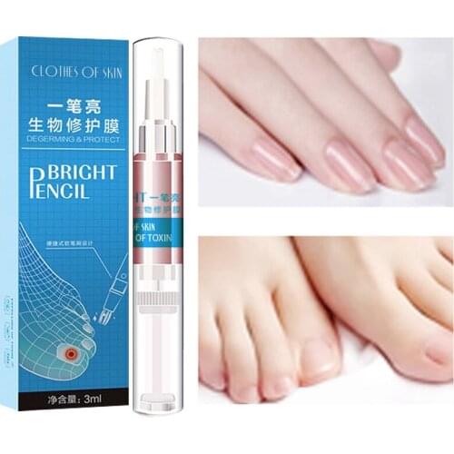 3ml 1pcs Nail Fungus Treatment Liquid Toenail Anti Fungal Nails Care Onychomycosis Nail Repair Supplies for Cracked Rough Nails