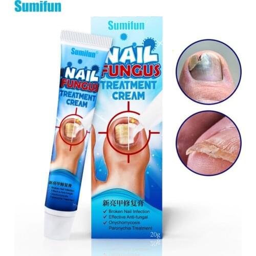 Sumifun 1box Nail Treatment Ointment Anti Infection Remove Onychomycosis Fungus Paronychia Promote Nail Growth Nail Care K10010