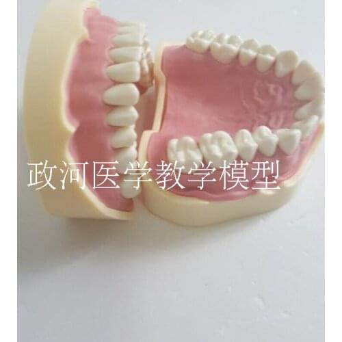 Dental model Gingival Oral Detachable Soft gum practice free shipping