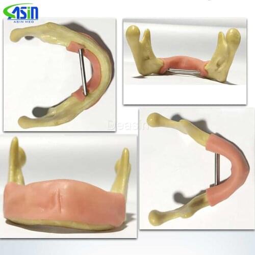 1 Piece Dental Implant Practice Teeth Model with Imitation Bone (Drilling) Silicone Soft Gum (Cutting/Stitching) Lower Jaw