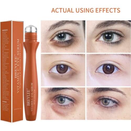 BREYLEE Eye Serum Eye Roller Massage Vitamin C Hyaluronic Acid Retinol Skin Care Eye Bags Cream Moisturizing Dark Circles 15ml