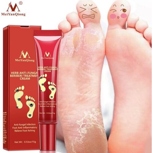 Herbal Effective Foot Cream Treatment Anti Fungal Infection Onychomycosis Toe Fungus Treatment Gel Heel Cracked Repair Cream