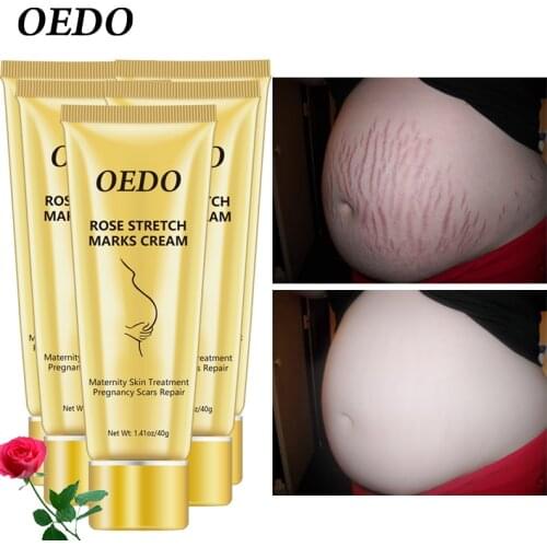 5PCS/lot Rose Remove Stretch Marks Cream Anti Wrinkle Anti Aging Maternity Skin Repair Remove Pregnancy Scars Treatment Body