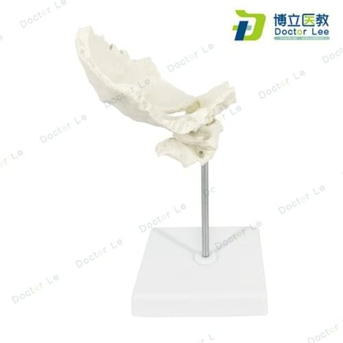 Life Size Atlas and Axis With Occipital Bone Model Spine Teaching Skeleton Model for Medical Education