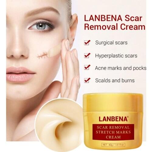 LANBENA 30g Acne Scar Removal Cream Pimples Stretch Mark Face Gel Remove Acne Smooth Whitening Moisturizing Body Skin Care TSLM1