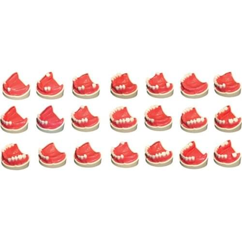 Dental Teeth Model Graghically Developing Model Metal Extraction Teeth Model Root Canal Model Missing Teeth with Silicon Rubber