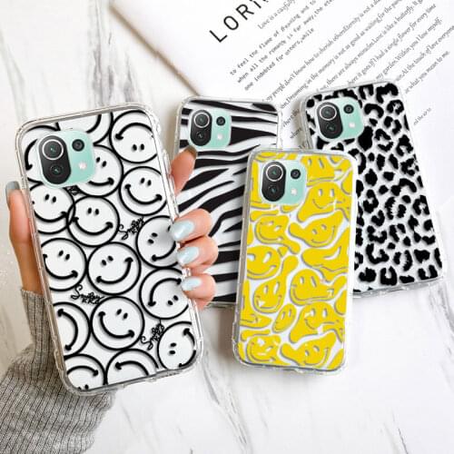 Mi 11 Lite Case For Xiaomi Redmi Note 10 9 8 Pro 7 10s 9s 9A 9C 8T Poco X3 NFC M3 F3 10T Note10 Cases Luxury Silicon Funda Cover