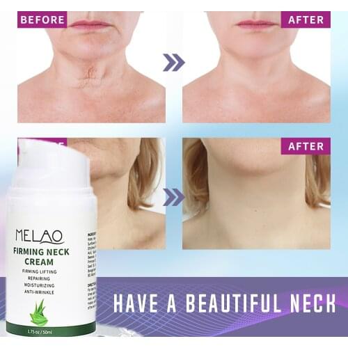 MABOX Neck Cream Firming Anti Wrinkle Fade Fine Lines Smooth Horizontal Line Collagen Lifting Neck Tight Skin Repair Skin Care