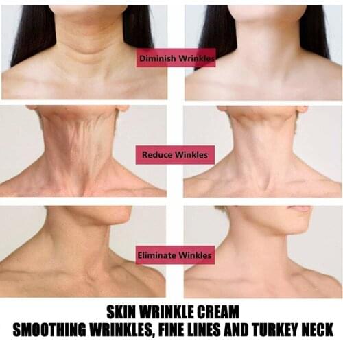 Skin Lightening Fine Lines Neck Cream Anti Wrinkle Whitening Firming Neck Mask Skin Care For Women WH998