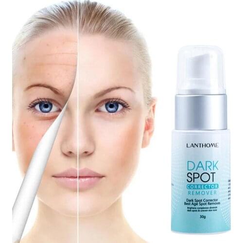 Powerful Whitening Freckle Cream Remove Acne Spots Melanin Dark Spots Face Lift Firming Face Skin Care Beauty Essentials 30g