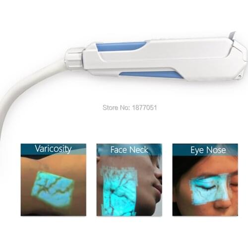 Hospital Injection Vein Locator Clinic Easy Use for Doctors Nurses