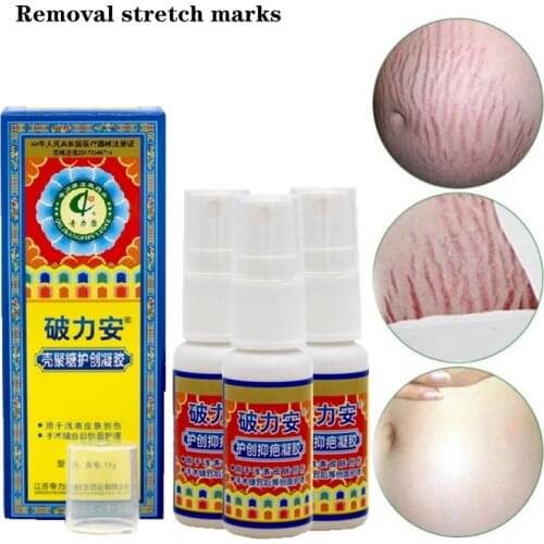Acne Scar Removal Cream Pregnancy Removal Gel Whitening Scald Treatment Scars Postoperative Repair Ointment Body Skin Care 3pcs
