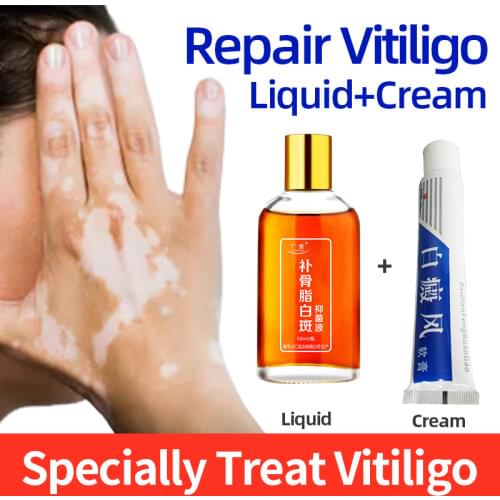50mlWhite Spot Disease Treatment Leukoplakia Repair Liquid Vitiligo Herbal Pigment Melanin Promoting Skin Care Spray