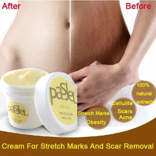 Pasjel new Arrival Effective AIVOYE stretch marks scar removal Cream slack line firming & lifting skin stretch mark repair cream