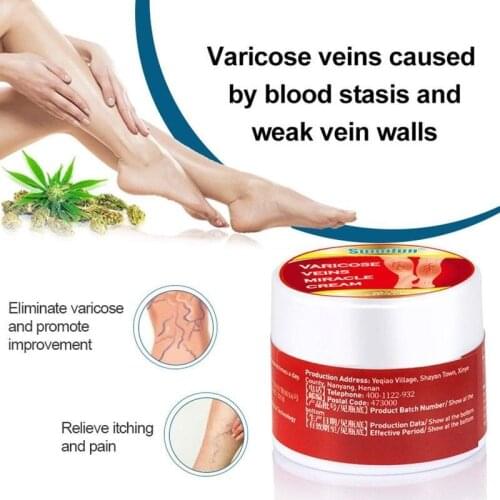 Varicose Veins Cream Anti-swelling Red Capillary Vasculitis Treatment Cream Pain Relief Ointment Herbal Medical Plaster